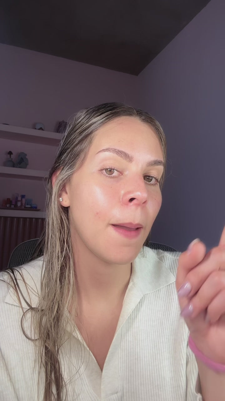 TRATAMIENTO ACNE